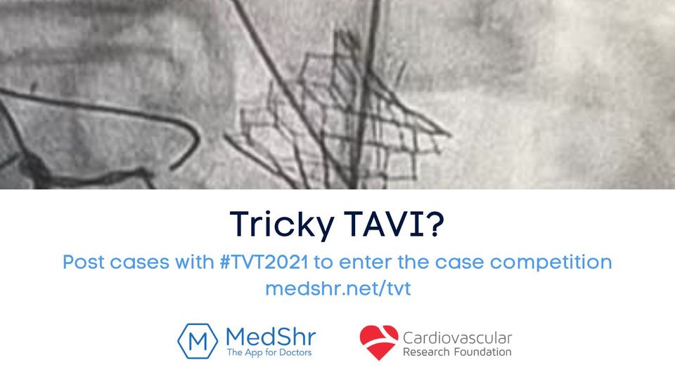 #TVT2021 Case Competition: Win a TCTMD Platinum subscription!