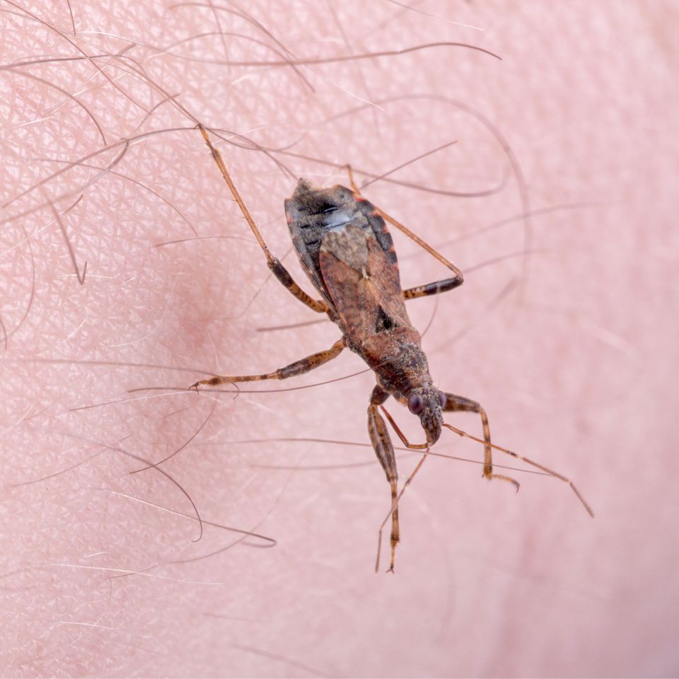 Chagas Disease - What You Need to Know