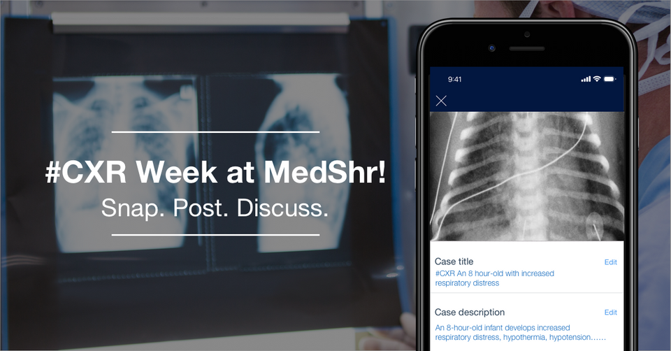 It’s Chest X-Ray week at MedShr!
