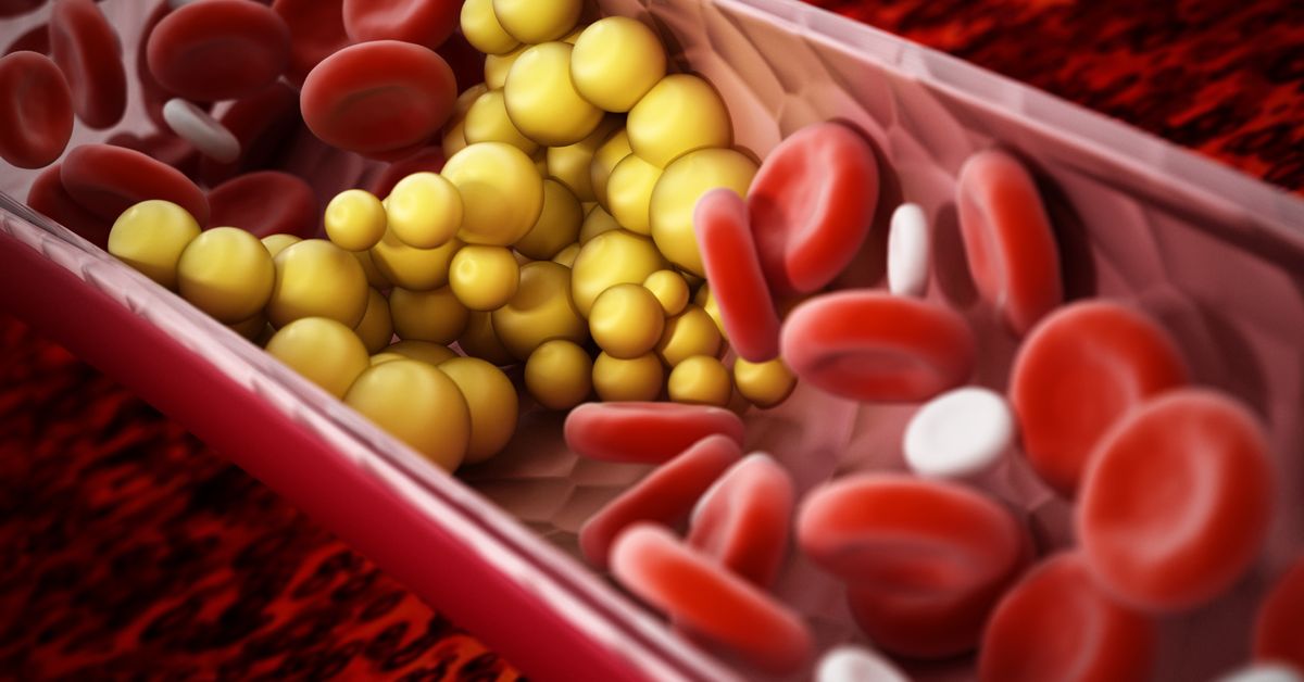 Injectable lipid lowering therapy may be considered for patients with ...