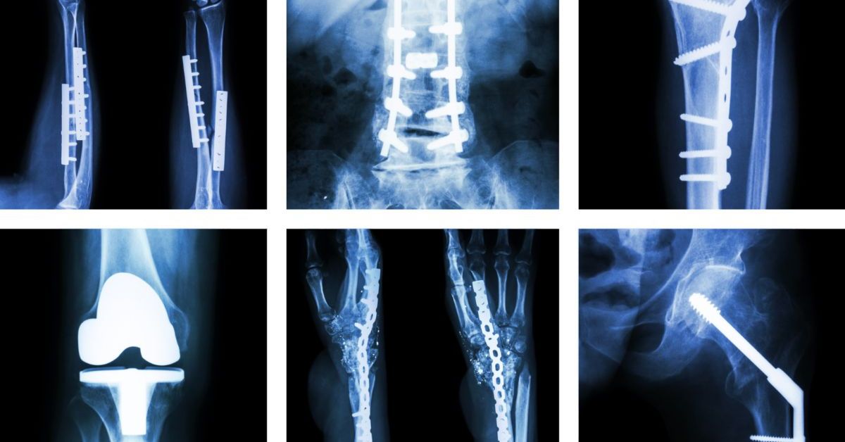 MedShr Learning | Module 8 - General Principles Of Orthopaedic X-rays ...