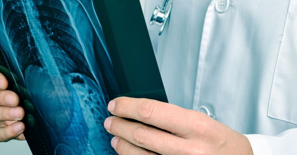 XRay Interpretation Course (20 CPD) Orthopaedic Academy