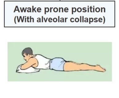 Supine Position: Benefits and When to Use [With Pictures]