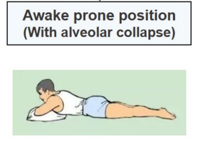 Why Prone Positioning