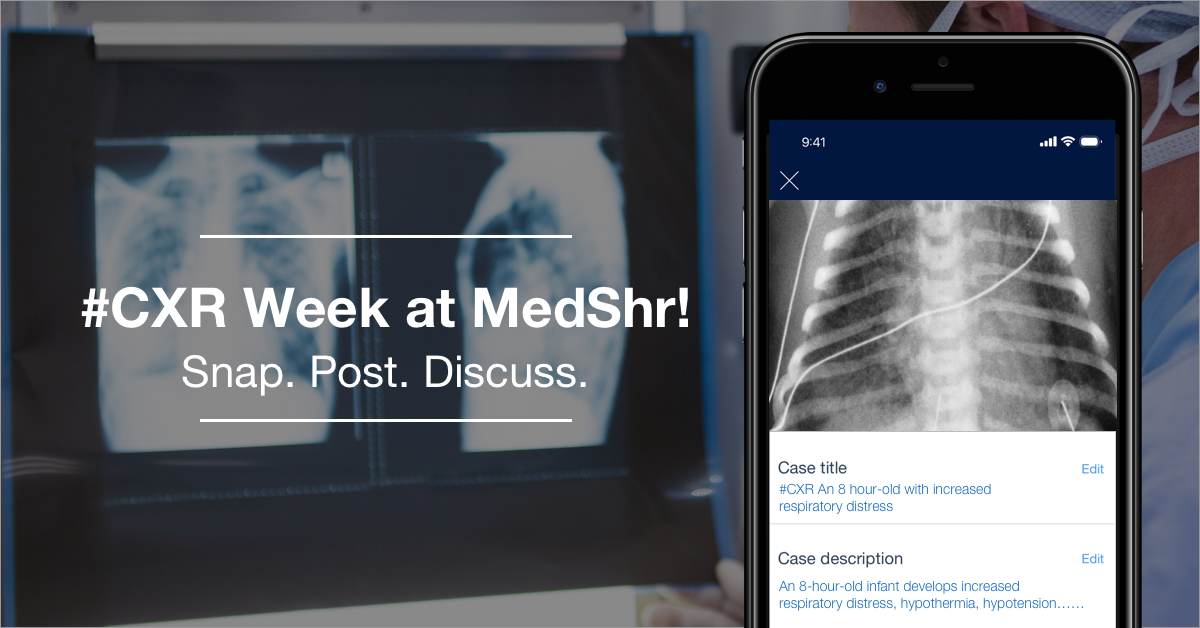 It’s Chest XRay week at MedShr!